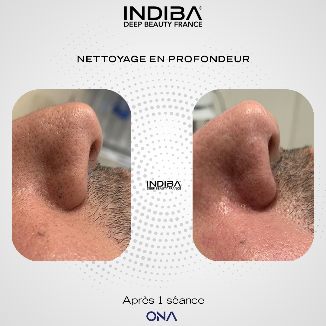 Soin-du-visage-ONA